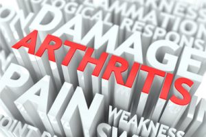 article-009-arthritis