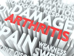 article-009-arthritis